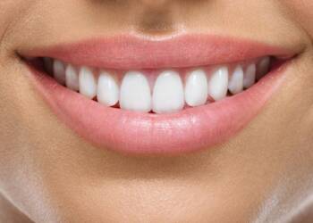 oval shape teeth smile