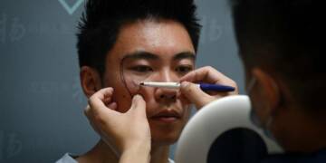 Not just women, Chinese men too are going under the knife to do better in life