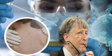 The Bill Gates connection behind the Monkeypox hysteria
