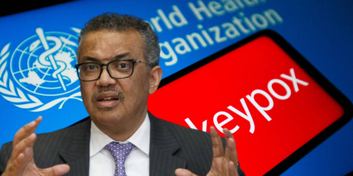 WHO’s big U-turn on Monkeypox is lethal for the entire world