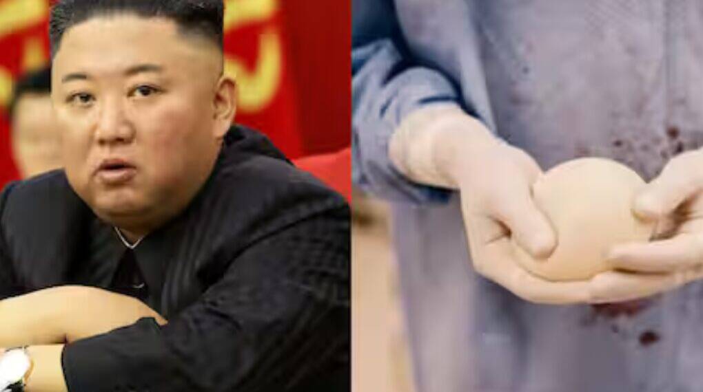 NO MORE BREAST IMPLATS: Why North Korea is Cracking Down on Cosmetic Surgeries?