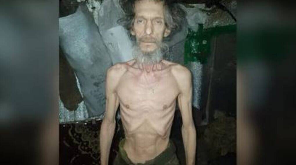 Ukraine Military Starvation Scandal: Shocking Images Expose Frontline Crisis